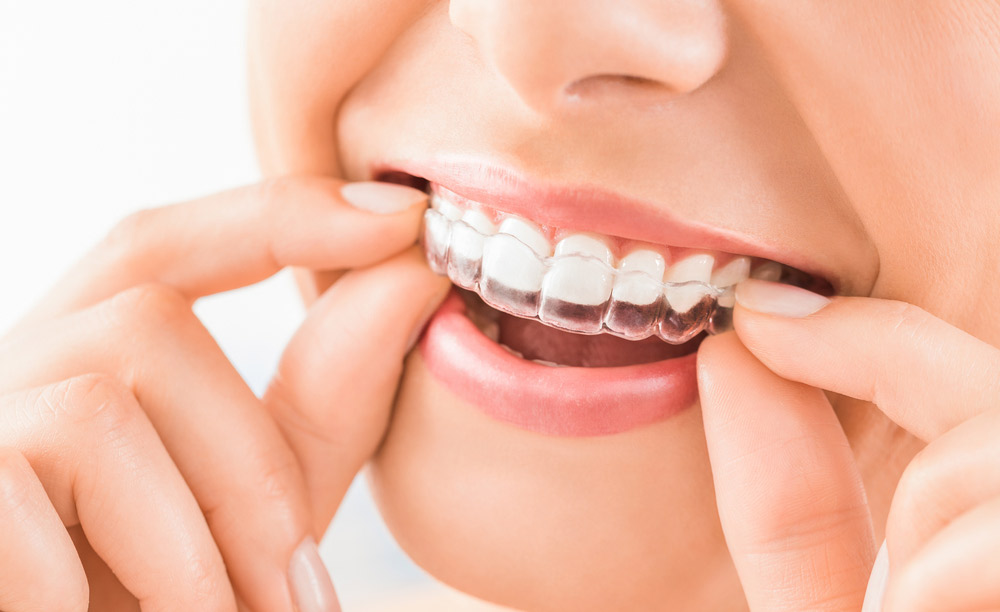 Invisalign Dentist Babylon NY